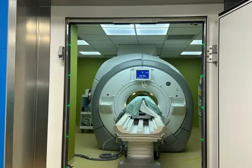 MRgFUS al Besta di Milano: la terapia senza bisturi che cambia il trattamento dei disturbi neurologici