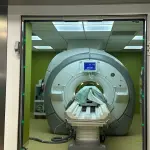 MRgFUS al Besta di Milano: la terapia senza bisturi che cambia il trattamento dei disturbi neurologici